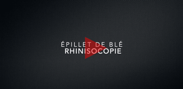 Image de lien vers la vidéo de Rhinoscopie